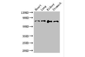 Western Blot Positive WB detected in: Mouse heart tissue, Mouse lung tissue, Mouse kidney tissue, Mouse stomach tissue All lanes: ABCG8 antibody at 2. (ABCG8 Antikörper  (AA 176-413))