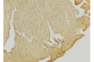 ABIN6274317 at 1/100 staining Mouse muscle tissue by IHC-P.