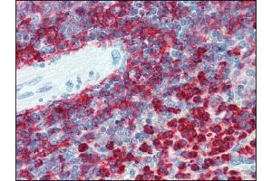 Immunohistochemistry (IHC) image for anti-Integrin beta 2 (ITGB2) antibody (ABIN614281) (Integrin beta 2 Antikörper)