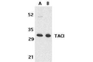 Western Blotting (WB) image for anti-Tumor Necrosis Factor Receptor Superfamily, Member 13B (TNFRSF13B) (N-Term) antibody (ABIN500863)