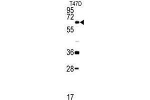 Western blot analysis of DDX5 antibody (C-term) in T47D cell line lysates (35ug/lane). (DDX5 Antikörper  (C-Term))