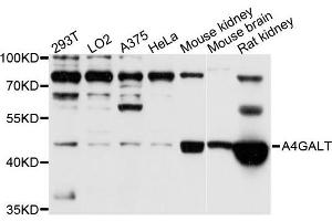 Western blot analysis of extracts of various cell lines, using A4GALT antibody (ABIN5995923) at 1/1000 dilution. (A4GALT Antikörper)