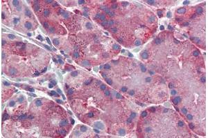 Human, Stomach: Formalin-Fixed Paraffin-Embedded (FFPE) (ERP44 Antikörper  (C-Term))