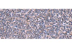 Immunohistochemistry of paraffin-embedded Human tonsil tissue using RIC3 Polyclonal Antibody at dilution of 1:90(x200) (RIC3 Antikörper)