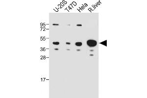 All lanes : Anti-IDAS Antibody (N-term) at 1:1000 dilution Lane 1: U-20S whole cell lysate Lane 2: T47D whole cell lysate Lane 3: Hela whole cell lysate Lane 4: Rat liver whole cell lysate Lysates/proteins at 20 μg per lane. (Multicilin Antikörper  (N-Term))