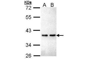 WB Image Sample (30 ug of whole cell lysate) A: Hela B: Hep G2 , 12% SDS PAGE antibody diluted at 1:5000