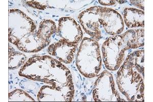 Immunohistochemical staining of paraffin-embedded Human Kidney tissue using anti-HIBCH mouse monoclonal antibody. (HIBCH Antikörper)