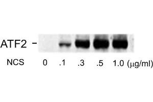Western blots of human melanoma cells incubated with varying doses of the radiomimetic drug NCS showing specific immuno-labeling of the ~74k ATF2 protein phosphorylated at Ser490 and Ser498. (ATF2 Antikörper  (pSer490, pSer498))