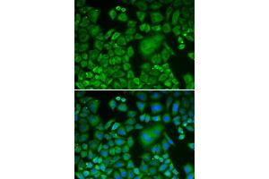 Immunofluorescence analysis of HeLa cells using ACTR3 antibody (ABIN5970423). (ACTR3 Antikörper)