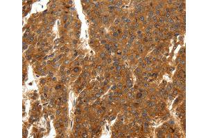 Immunohistochemistry (IHC) image for anti-Sodium Channel, Voltage-Gated, Type XI, alpha Subunit (SCN11A) antibody (ABIN2432261) (SCN11A Antikörper)