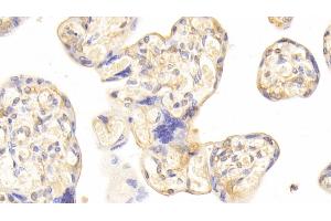 Detection of CDO1 in Human Placenta Tissue using Polyclonal Antibody to Cysteine Dioxygenase I (CDO1) (CDO1 Antikörper  (AA 1-200))