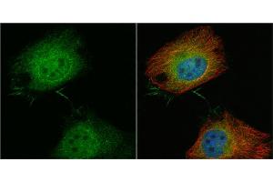 ICC/IF Image T-Plastin antibody detects T-Plastin protein at cytoplasm and nucleus by immunofluorescent analysis. (Plastin 3 Antikörper)
