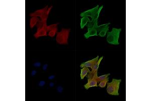 Phospho-RYR2 (Ser2030) Antibody staining HepG2 cells(serum starvation treatment) by IF/ICC. (RYR2 Antikörper  (pSer2030))