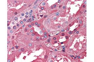Immunohistochemistry (IHC) image for anti-Albumin (ALB) (N-Term) antibody (ABIN2776969) (Albumin Antikörper  (N-Term))
