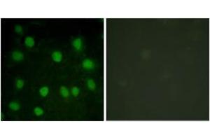 Immunofluorescence analysis of HuvEc cells, using Dematin (Ab-403) Antibody. (Dematin Antikörper  (AA 356-405))