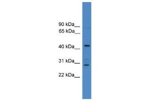 WB Suggested Anti-ARMC8 Antibody Titration: 0. (ARMC8 Antikörper  (N-Term))