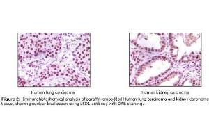 Image no. 1 for anti-Lysine (K)-Specific Demethylase 1A (KDM1A) antibody (ABIN207611) (LSD1 Antikörper)