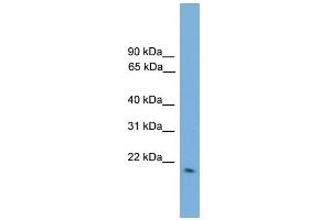 WB Suggested Anti-GPX2 Antibody Titration:  0.