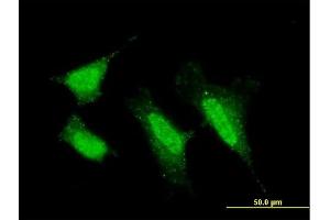 Immunofluorescence of monoclonal antibody to PRKCI on HeLa cell. (PKC iota Antikörper  (AA 1-587))