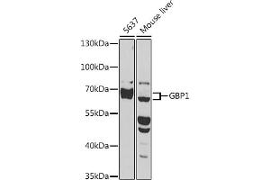 Western blot analysis of extracts of various cell lines, using GBP1 antibody (ABIN1679963, ABIN3018227, ABIN3018228 and ABIN6220409) at 1:1000 dilution.