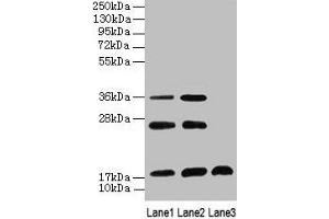 Western Blot All lanes: SFT2D2 antibody at 8 μg/mL Lane 1: Mouse liver tissue Lane 2: Mouse kidney tissue Lane 3: Mouse thymus tissue Secondary Goat polyclonal to rabbit IgG at 1/10000 dilution Predicted band size: 18 kDa Observed band size: 18, 26, 36 kDa (SFT2D2 Antikörper  (AA 1-36))