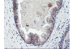 Image no. 3 for anti-Dystrobrevin, beta (DTNB) antibody (ABIN1497913) (Dystrobrevin beta Antikörper)