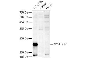 Western blot analysis of extracts of various cell lines, using NY-ESO-1 antibody (ABIN6129965, ABIN6139172, ABIN6139173 and ABIN6225112) at 1:1000 dilution. (CTAG1B Antikörper  (AA 1-180))