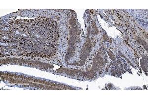 IHC analysis of SAMHD1 using anti-SAMHD1 antibody (ABIN7601514). (SAMHD1 Antikörper  (AA 37-626))