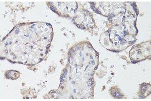 Immunohistochemistry of paraffin-embedded Human placenta using TrkB Polyclonal Antibody at dilution of 1:200 (40x lens). (TRKB Antikörper)
