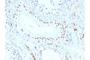 Formalin-fixed, paraffin-embedded Human Testis stained with Wilm's Tumor Mouse Monoclonal Antibody (WT1/857). (WT1 Antikörper)