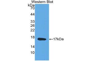 Western blot analysis of the recombinant protein. (Midkine Antikörper  (AA 22-143))