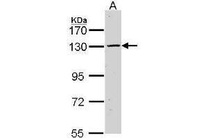 WB Image Sample (30 ug of whole cell lysate) A: Hela 7. (CASR Antikörper)