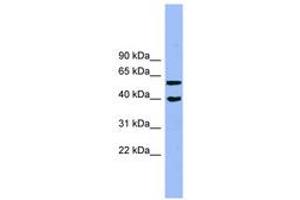 Image no. 1 for anti-Allantoicase (ALLC) (AA 71-120) antibody (ABIN6744149) (Allantoicase Antikörper  (AA 71-120))