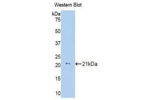 Western Blotting (WB) image for anti-Collagen, Type VIII, alpha 2 (COL8A2) (AA 533-698) antibody (ABIN1176005) (COL8a2 Antikörper  (AA 533-698))