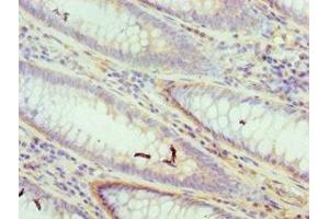 Immunohistochemistry (IHC) image for anti-DNA Fragmentation Factor, 45kDa, alpha Polypeptide (DFFA) (AA 1-331) antibody (ABIN7150176)
