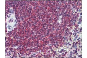 Human Spleen: Formalin-Fixed, Paraffin-Embedded (FFPE) (CA1 Antikörper  (Internal Region))
