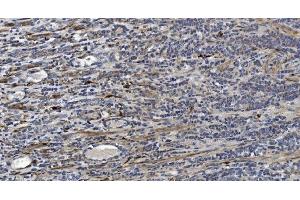 IHC analysis of Alpha B Crystallin/CRYAB using anti-Alpha B Crystallin/CRYAB antibody (ABIN7601209). (CRYAB Antikörper  (AA 30-151))