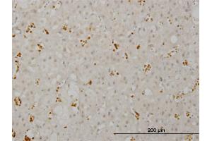 Immunoperoxidase of monoclonal antibody to SMG1 on formalin-fixed paraffin-embedded human adrenal gland. (SMG1 Antikörper  (AA 2922-3031))