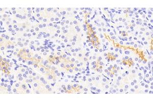 Detection of Kim1 in Human Kidney Tissue using Polyclonal Antibody to Kidney Injury Molecule 1 (Kim1) (HAVCR1 Antikörper  (AA 21-240))
