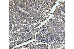 IHC analysis of MEK3 using anti-MEK3 antibody (ABIN3043874).