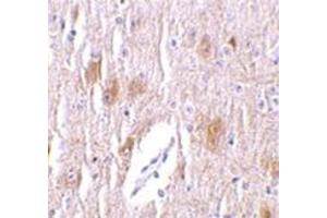 Immunohistochemistry of TRIM5 delta in mouse brain tissue with this product at 1 μg/ml.