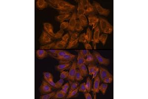 Immunofluorescence analysis of U-2 OS cells using J Rabbit pAb (ABIN7268038) at dilution of 1:100 (40x lens). (JAK1 Antikörper  (AA 120-380))