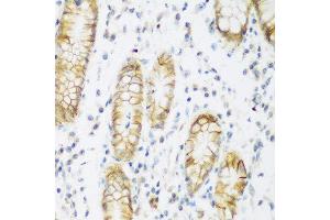Immunohistochemistry of paraffin-embedded human stomach using KIAA1456 antibody at dilution of 1:200 (40x lens). (KIAA1456 Antikörper)