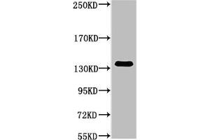 Western blot analysis of Hela, diluted at 1:1000. (COL3A1 Antikörper)