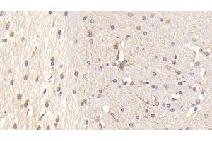 Detection of PTPRS in Mouse Cerebrum Tissue using Polyclonal Antibody to Protein Tyrosine Phosphatase Receptor Type S (PTPRS) (PTPRS Antikörper  (AA 889-1102))