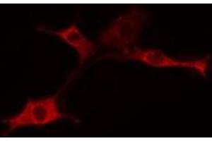 ABIN6275358 staining 293 cells by IF/ICC. (PIGX Antikörper  (Internal Region))