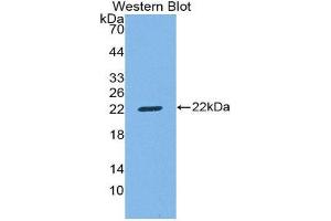 Western Blotting (WB) image for anti-CD8b Molecule (CD8B) (AA 22-175) antibody (ABIN1858319)