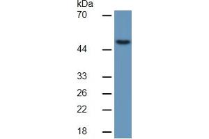 Western Blotting (WB) image for Matrix Metallopeptidase 13 (Collagenase 3) (MMP13) ELISA Kit (ABIN6730928)