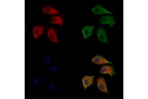 ABIN6266012 and ABIN6272461 staining Hela cells by IF/ICC. (WASF1 Antikörper  (Internal Region))