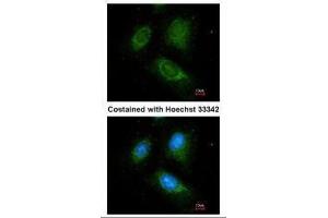 ICC/IF Image Immunofluorescence analysis of methanol-fixed HeLa, using ACADM, antibody at 1:100 dilution. (Medium-Chain Specific Acyl-CoA Dehydrogenase, Mitochondrial (N-Term) Antikörper)